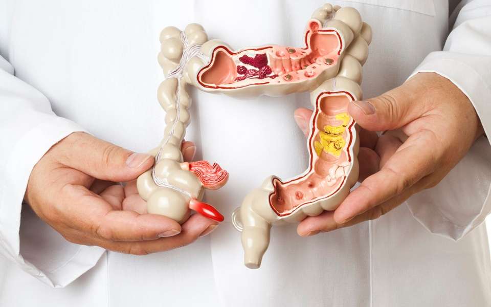Adiamento de diagnóstico do cancro digestivo pode elevar as taxas de mortalidade .